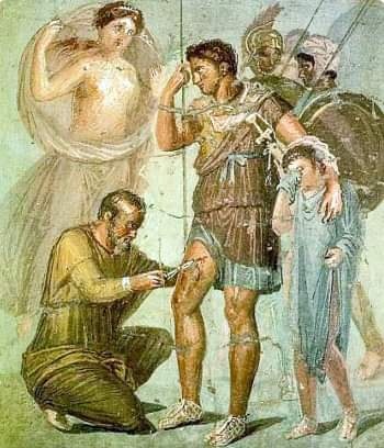 로마인의 조상인 아이네아스가 허벅지에 박힌 화살을 제거하는 모습
